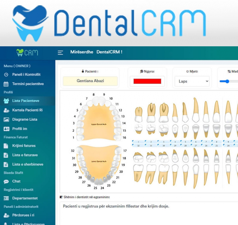 Foto 2 - Dental CRM – Menaxhimi Modern i Klinikes Dentare